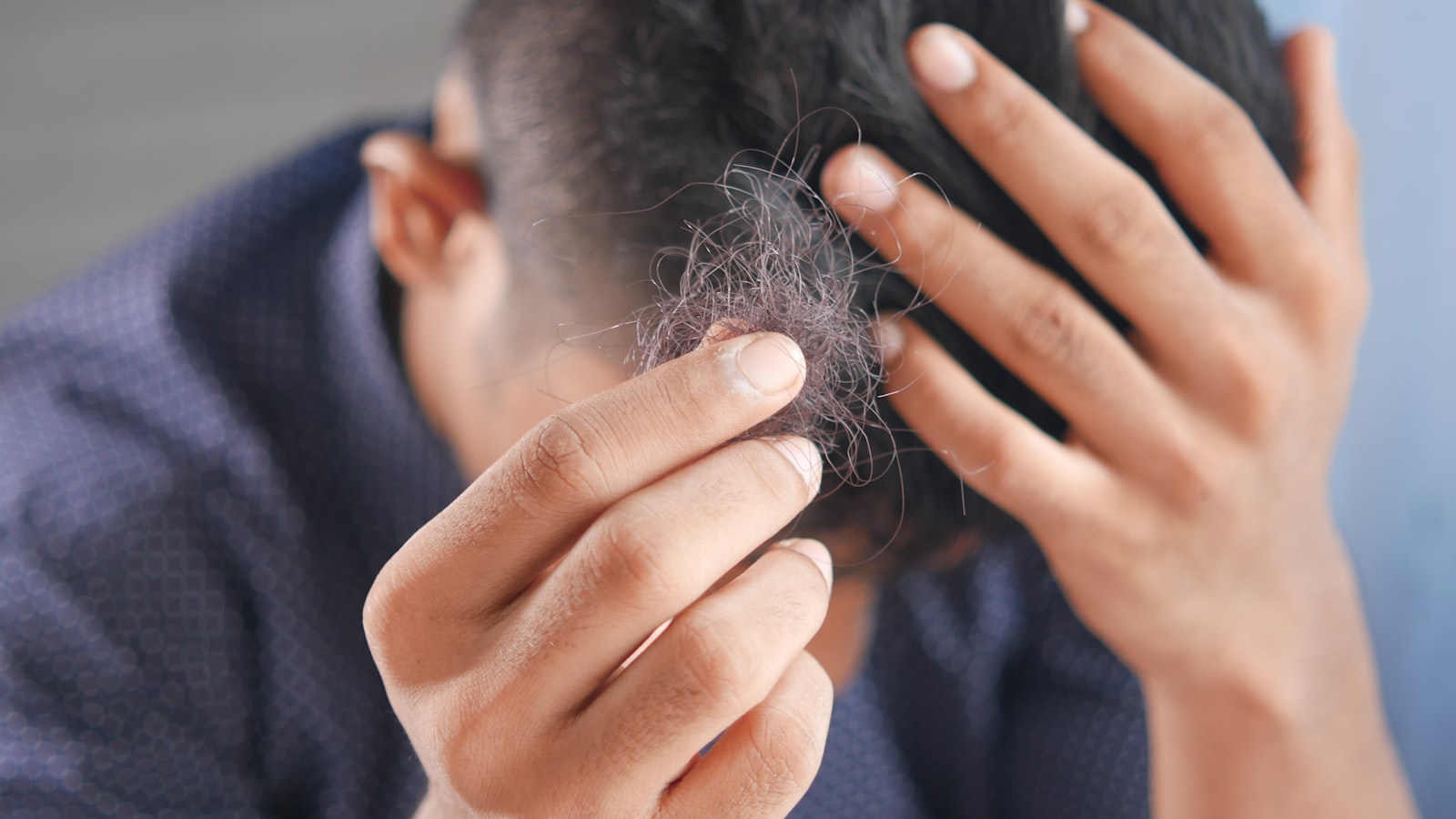 Pessoa a passar as mãos pelo cabelo, preocupada com a queda