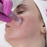 Tratamento de microagulhamento facial numa clínica